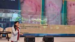 Perdana Bedah Plastik, Rekonstruksi dan Estetik dengan Standar Korea Selatan di Siloam Hospital TB Simatupang